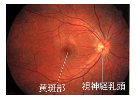 正常眼底
