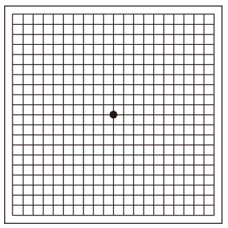 アムスラー検査