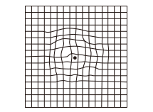 中心がゆがんで見える