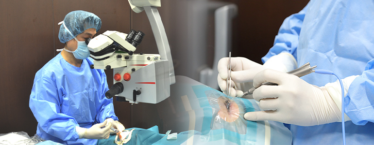 手術・レーザー治療のご案内