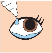 抗血管新生療法（抗VEGF治療薬）は痛いの？